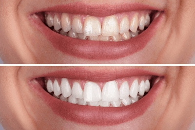 Citrus Dental Care