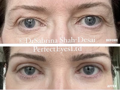 Perfect Eyes Ltd.