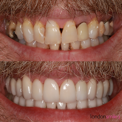 The London Smile Clinic